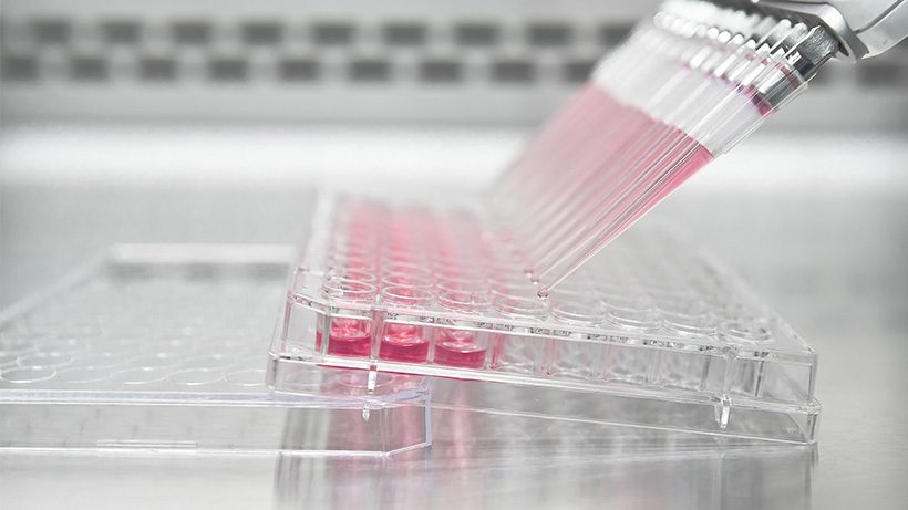 Serología IgM - IgG