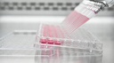 Serología IgM - IgG